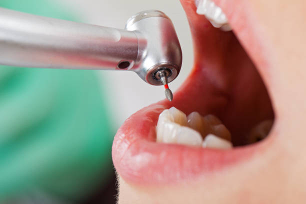 Best Tooth Infection Emergency Dentist  in Golden Beach, MD